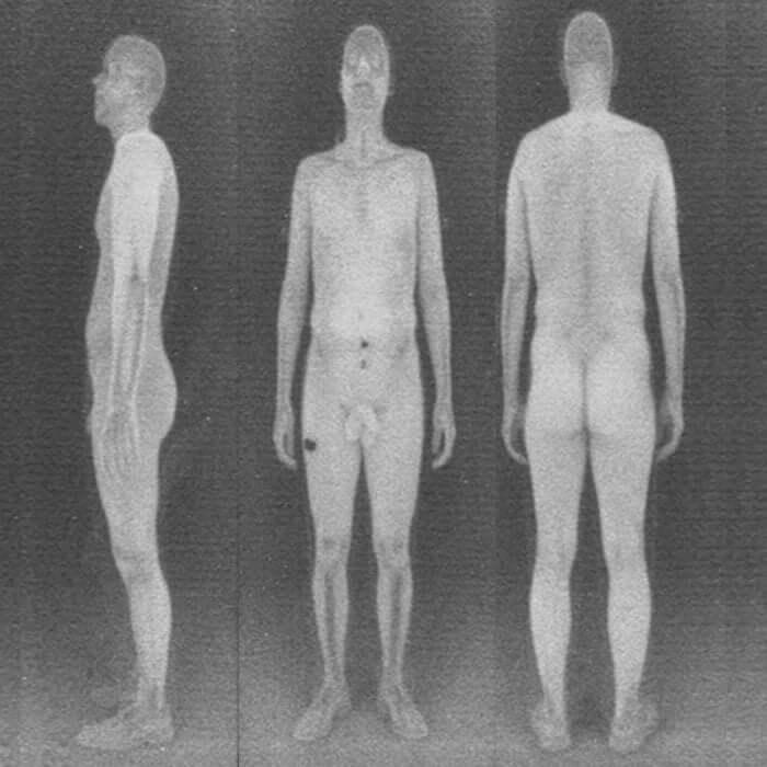 X-Ray FTM traveling